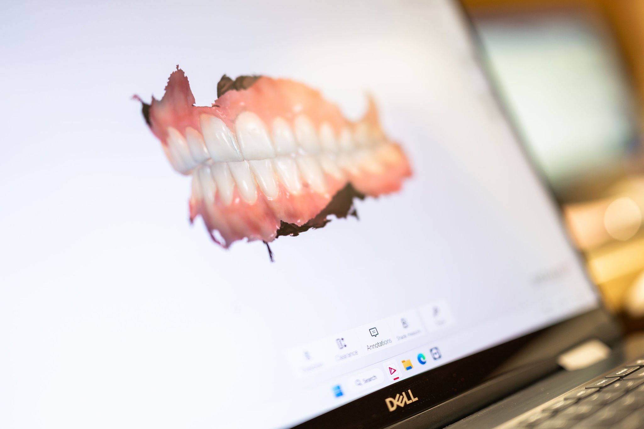 Wilckodontics | Lake Norman Oral & Facial Surgery, Huntersville, NC