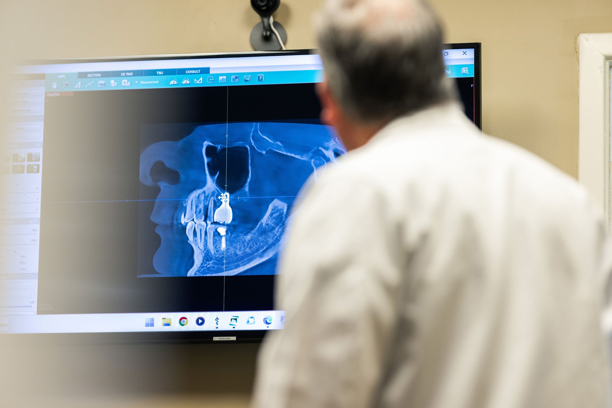 3D jaw scan technology